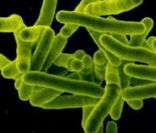 Bacilo de Koch: causador da tuberculose