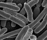 Escherichia coli (imagem aumentada em microscópio)