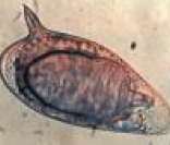 Ovo do Shistosoma Mansoni: parasita causador da forma intestinal da Esquistossomose