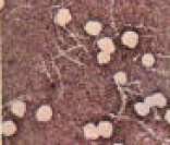 Treponema pallidum: bactéria causadora da sífilis