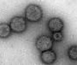 Imagem de microscópio do vírus influenza (gripe)