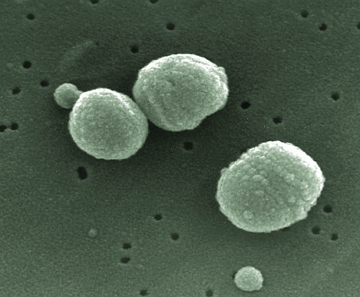 Streptococcus pneumoniae, bactéria causadora da pneumonia Streptococcus pneumoniae, bactéria causadora da pneumonia