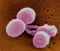 Streptococcus pneumoniae, bactéria causadora da pneumonia