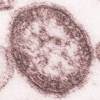 Imagem microscópica de um vírus do sarampo